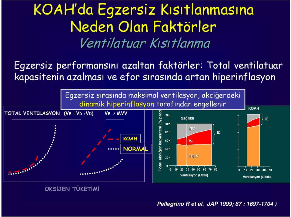 hiperinflasyon Egzersiz sırasında maksimal ventilasyon, akciğerdeki dinamik hiperinflasyon tarafından