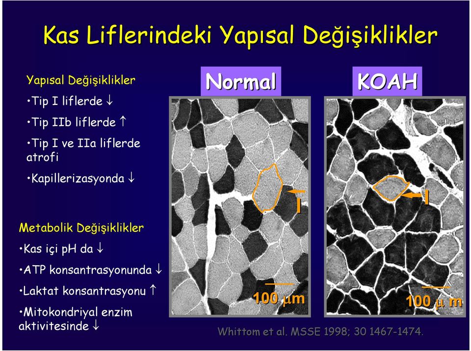 Değişiklikler Kas içi ph da ATP konsantrasyonunda Laktat konsantrasyonu