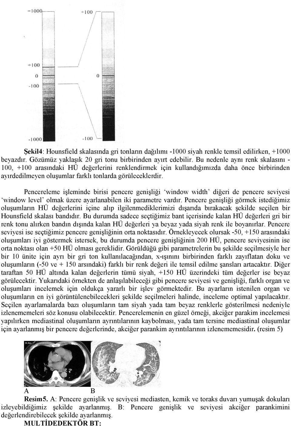 Pencereleme işleminde birisi pencere genişliği window width diğeri de pencere seviyesi window level olmak üzere ayarlanabilen iki parametre vardır.