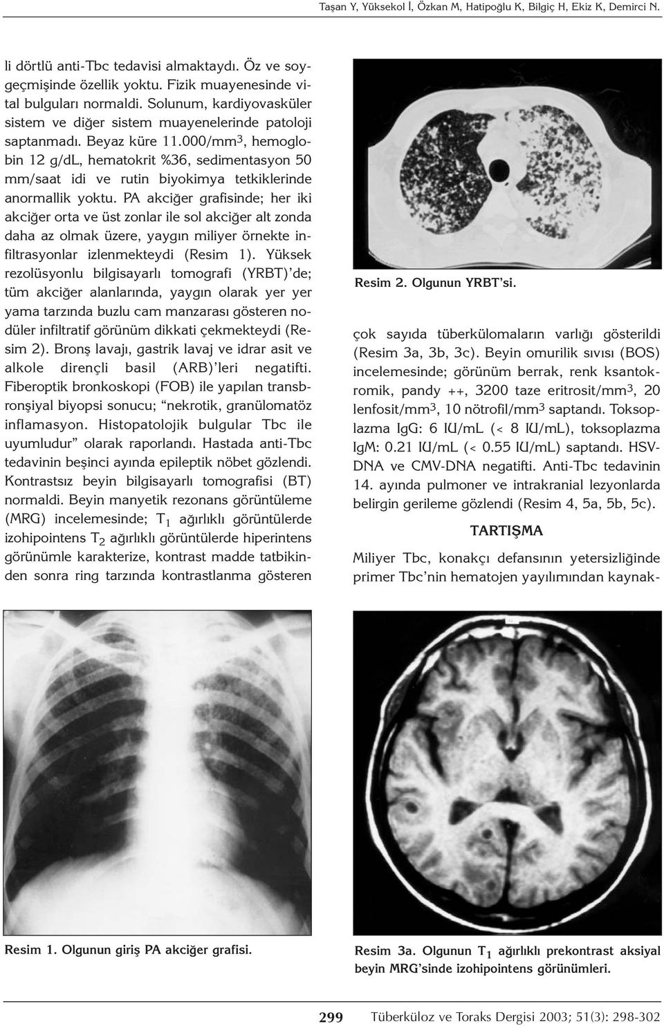 000/mm 3, hemoglobin 12 g/dl, hematokrit %36, sedimentasyon 50 mm/saat idi ve rutin biyokimya tetkiklerinde anormallik yoktu.