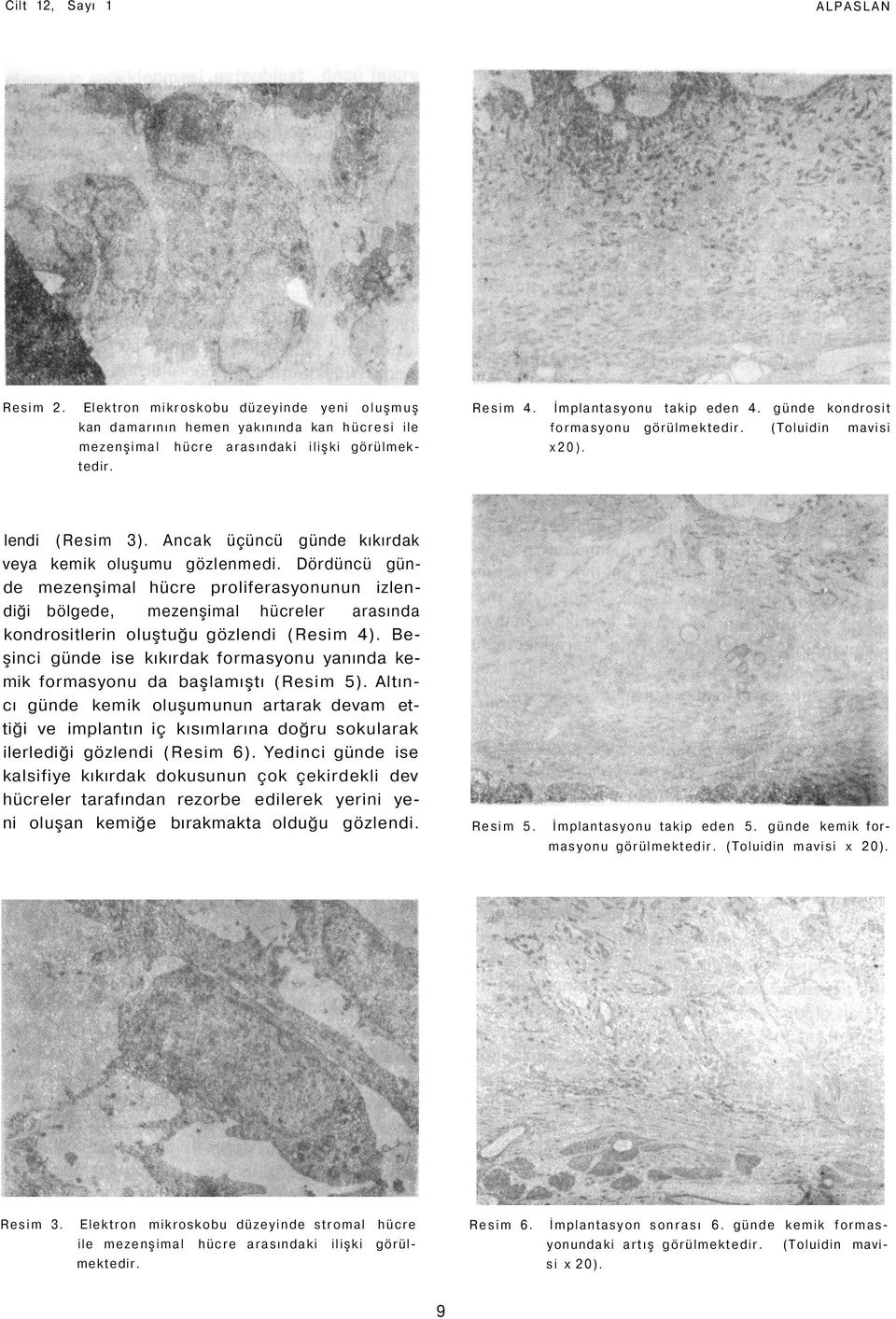 Dördüncü günde mezenşimal hücre proliferasyonunun izlendiği bölgede, mezenşimal hücreler arasında kondrositlerin oluştuğu gözlendi (Resim 4).