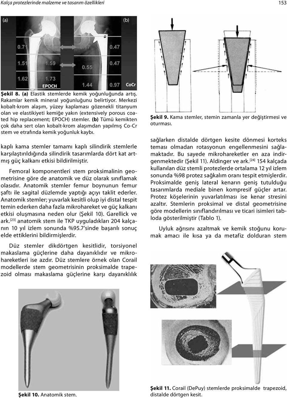 (b) Tümü kemikten çok daha sert olan kobalt-krom alaşımdan yapılmış Co-Cr stem ve etrafında kemik yoğunluk kaybı.