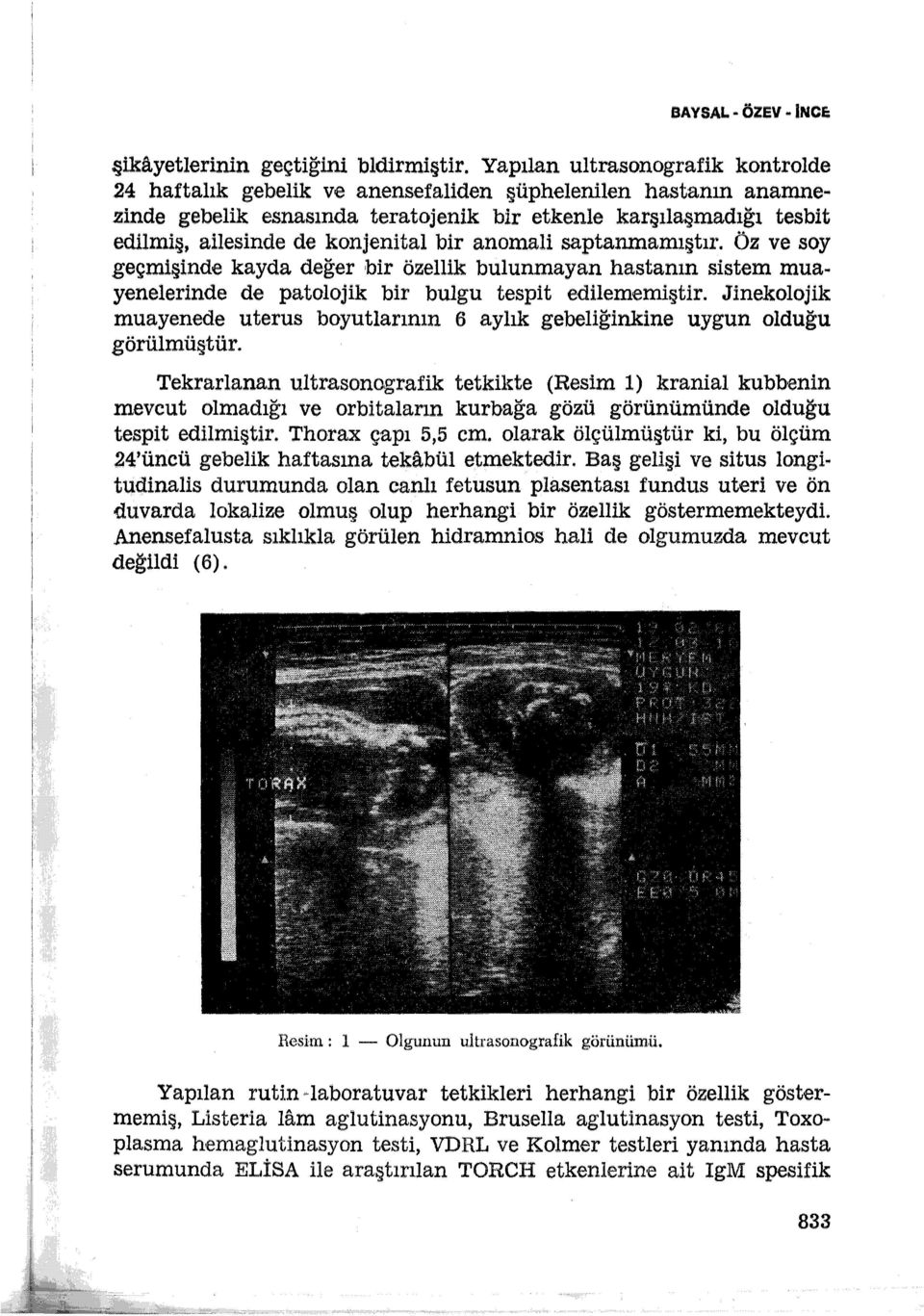 öz ve soy geçmişinde kayda değer bir özellik bulunmayan hastanın sistem muayenelerinde de patolojik bir bulgu tespit edilememiştir.