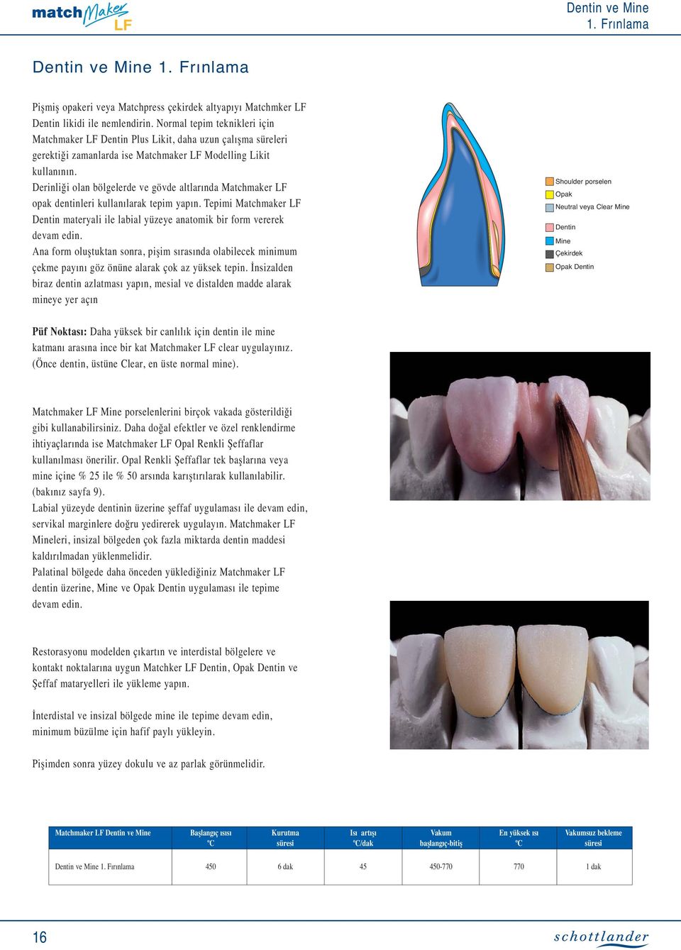 Derinliği olan bölgelerde ve gövde altlarında Matchmaker LF opak dentinleri kullanılarak tepim yapın. Tepimi Matchmaker LF Dentin materyali ile labial yüzeye anatomik bir form vererek devam edin.