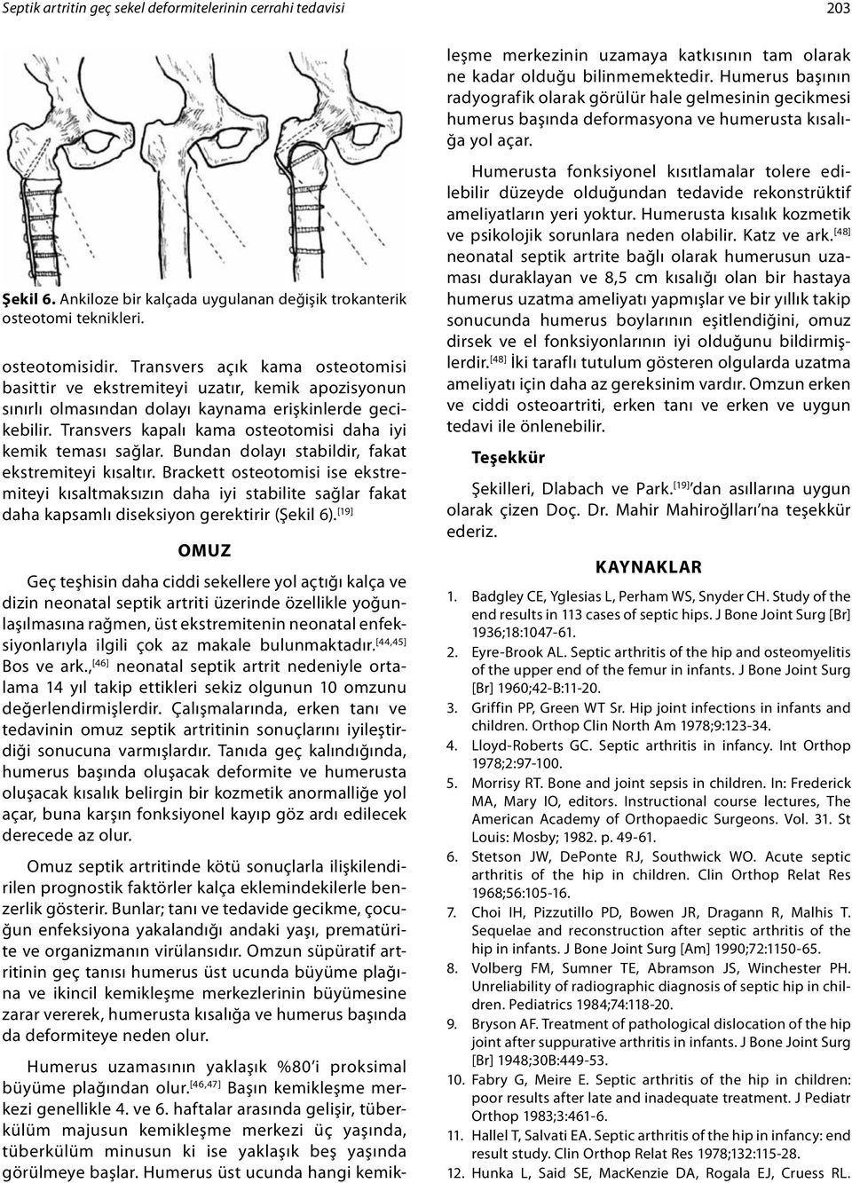 Transvers kapalı kama osteotomisi daha iyi kemik teması sağlar. undan dolayı stabildir, fakat ekstremiteyi kısaltır.