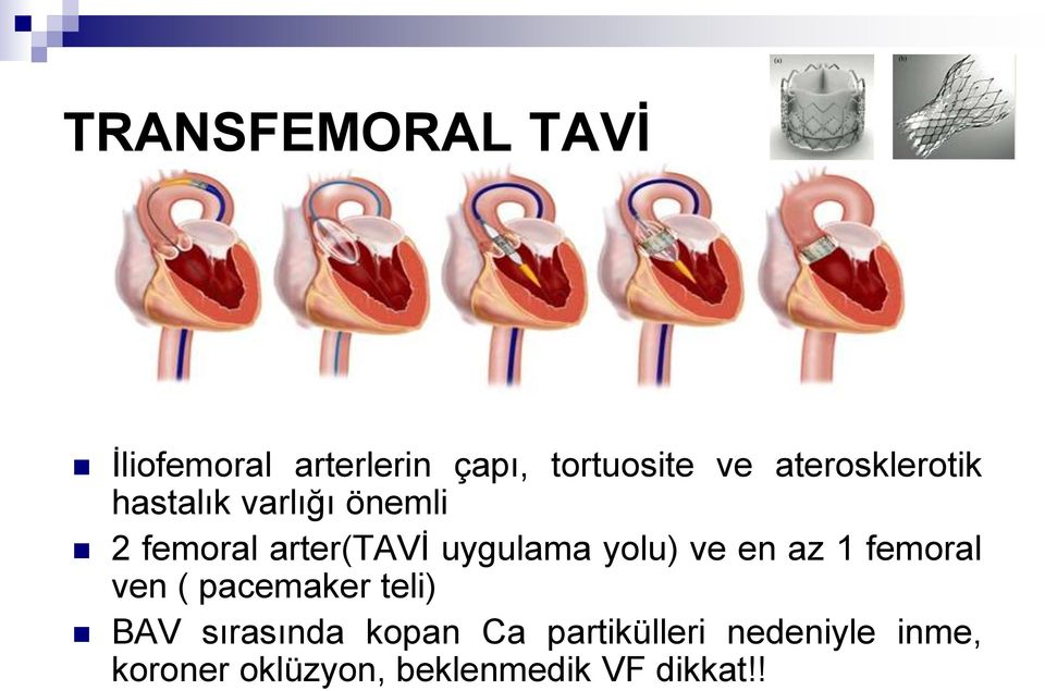 uygulama yolu) ve en az 1 femoral ven ( pacemaker teli) BAV