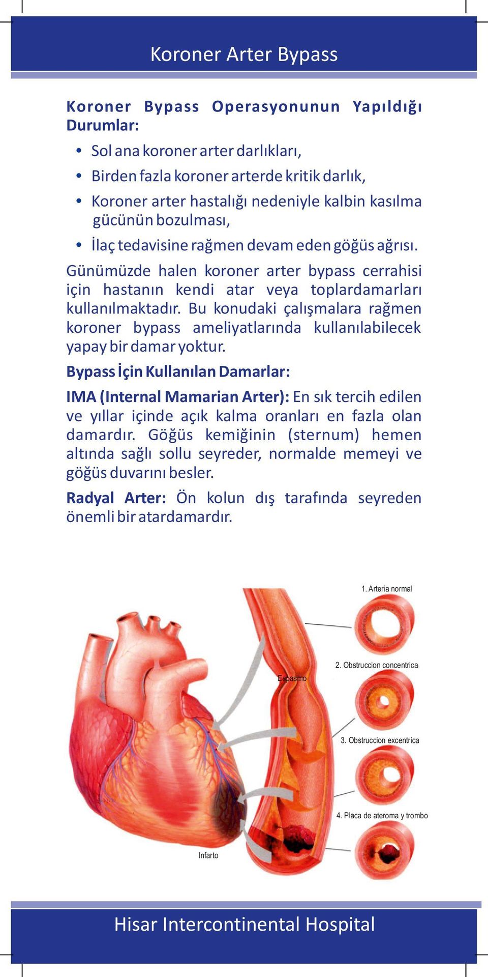 Bu konudaki çalışmalara rağmen koroner bypass ameliyatlarında kullanılabilecek yapay bir damar yoktur.