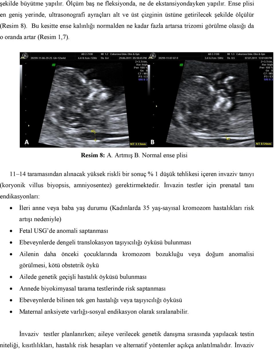 Bu kesitte ense kalınlığı normalden ne kadar fazla artarsa trizomi görülme olasığı da o oranda artar (Resim 1,7). Resim 8: A. Artmış B.