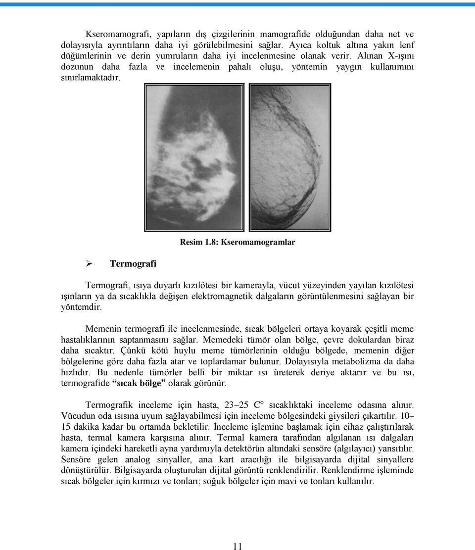 Alınan X-ıĢını dozunun daha fazla ve incelemenin pahalı oluģu, yöntemin yaygın kullanımını sınırlamaktadır. Termografi Resim 1.