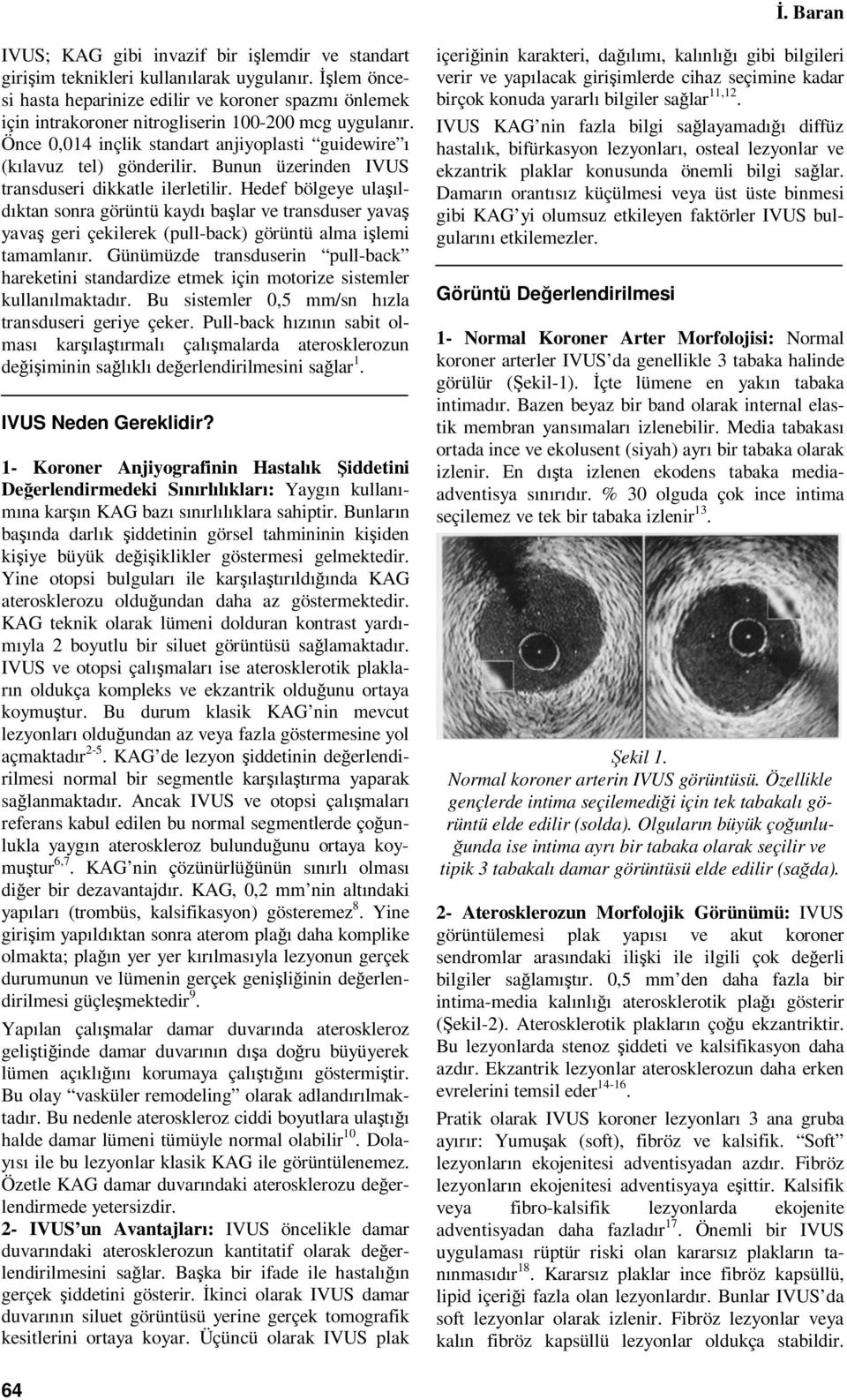 Bunun üzerinden IVUS transduseri dikkatle ilerletilir. Hedef bölgeye ulaşıldıktan sonra görüntü kaydı başlar ve transduser yavaş yavaş geri çekilerek (pull-back) görüntü alma işlemi tamamlanır.