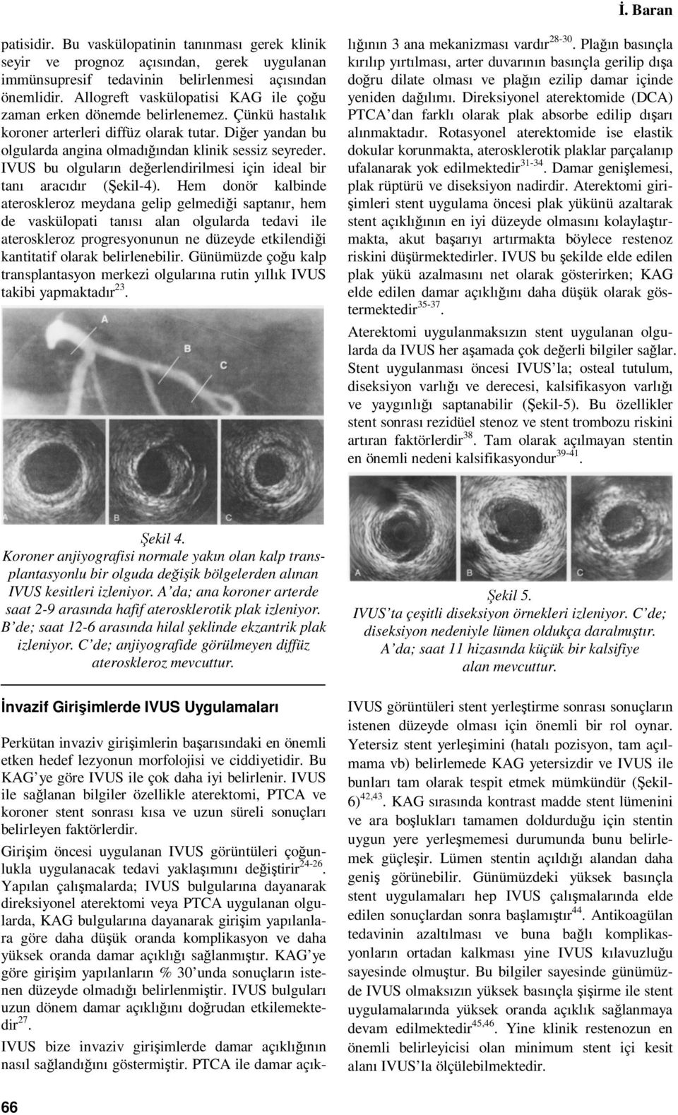 IVUS bu olguların değerlendirilmesi için ideal bir tanı aracıdır (Şekil-4).