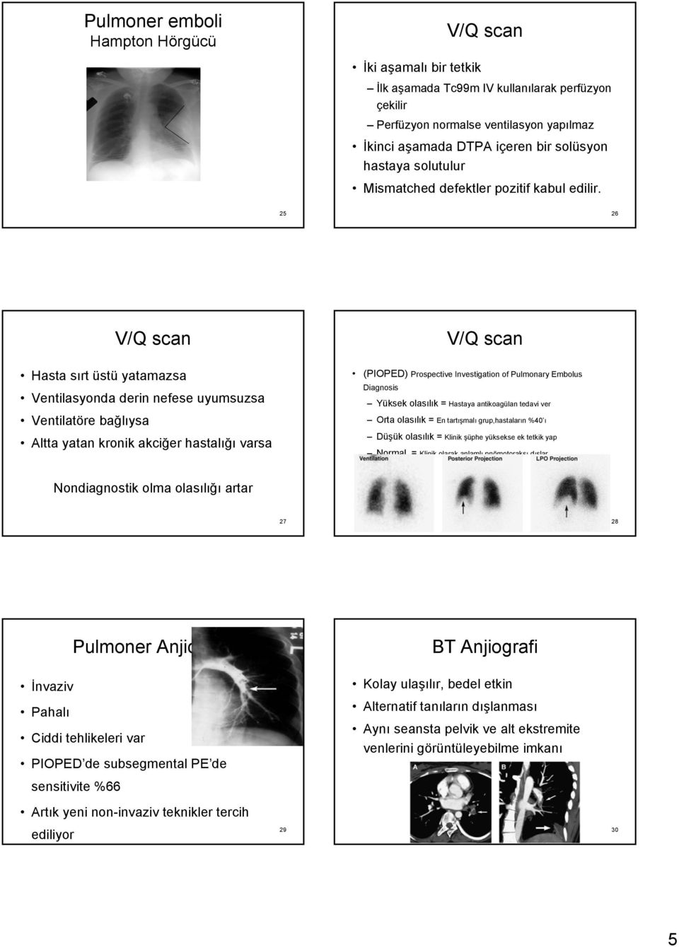 25 26 V/Q scan Hasta sırt üstü yatamazsa Ventilasyonda derin nefese uyumsuzsa Ventilatöre bağlıysa Altta yatan kronik akciğer hastalığı varsa V/Q scan (PIOPED) Prospective Investigation of Pulmonary