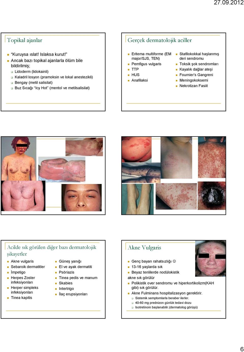 Eritema multiforme (EM major/sjs, TEN) Pemfigus vulgaris TTP HUS Anafilaksi Stafilokokkal haşlanmış deri sendromu Toksik şok sendromları Kayalık dağlar ateşi Fournier s Gangreni Meningokoksemi