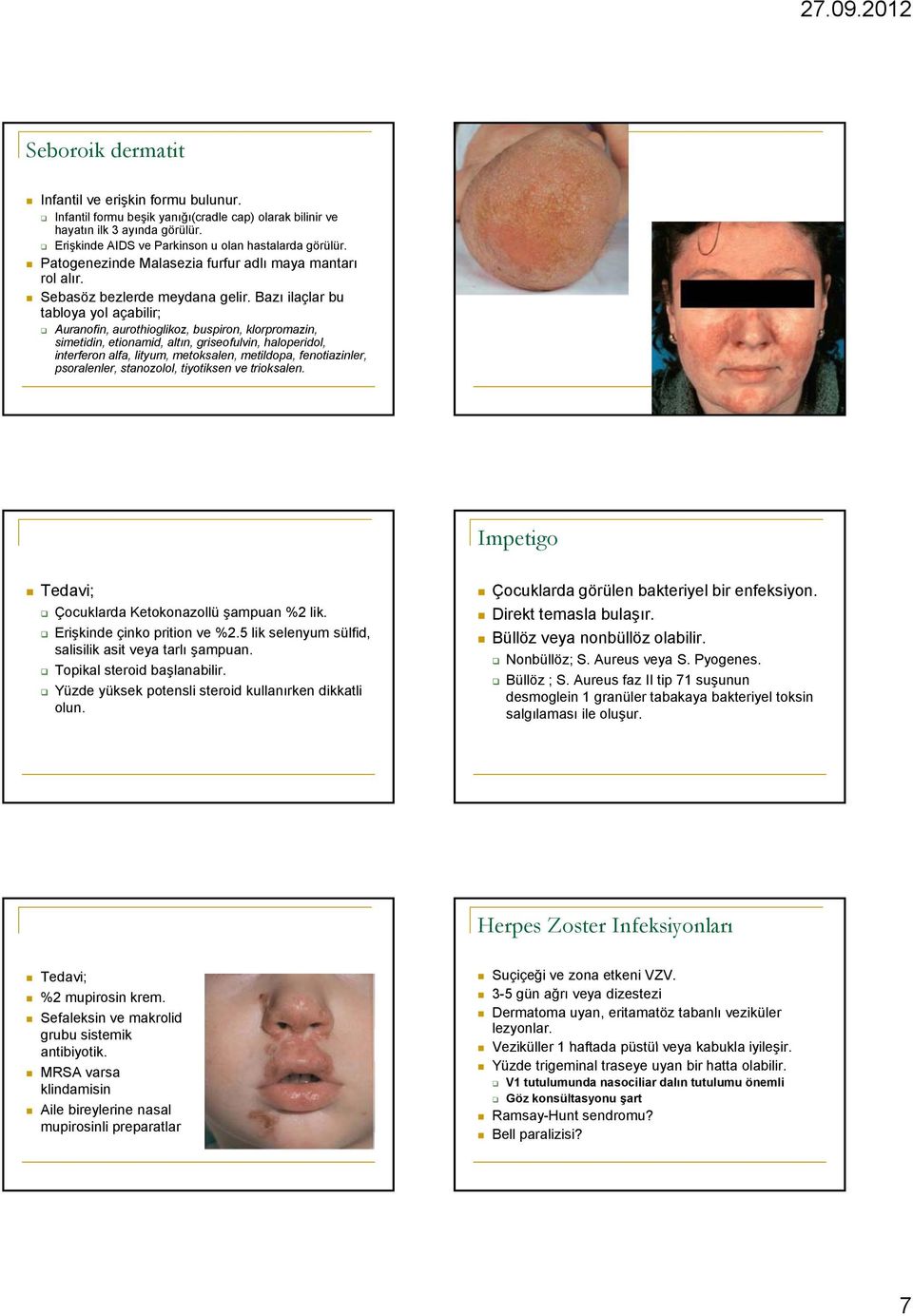 Bazı ilaçlar bu tabloya yol açabilir; Auranofin, aurothioglikoz, buspiron, klorpromazin, simetidin, etionamid, altın, griseofulvin, haloperidol, interferon alfa, lityum, metoksalen, metildopa,