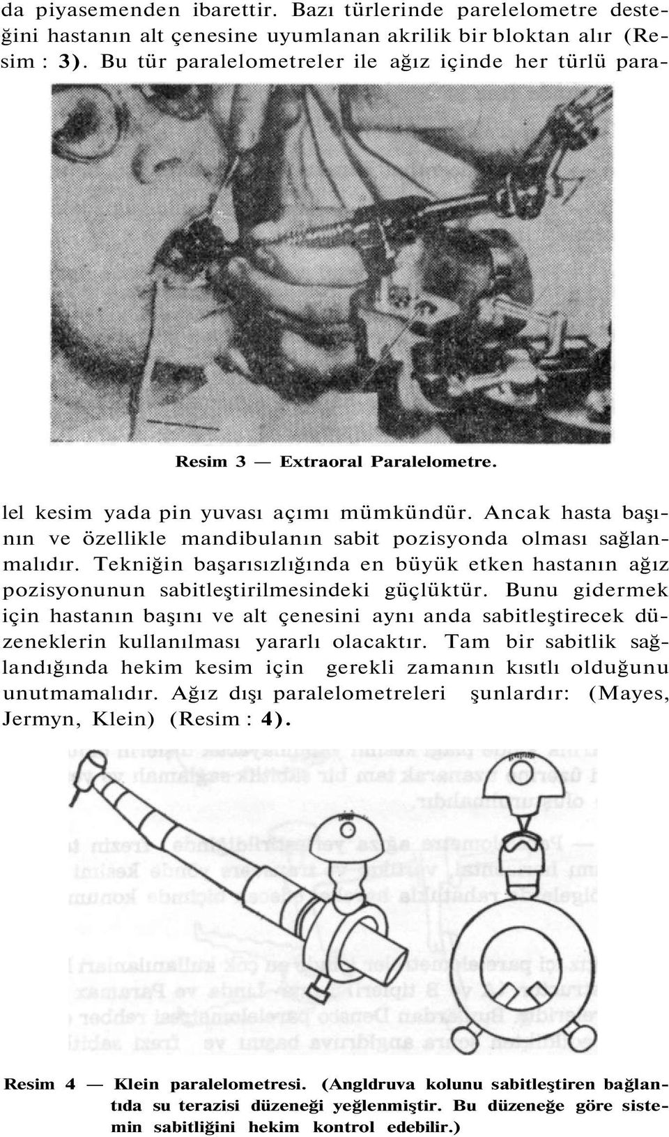 Ancak hasta başının ve özellikle mandibulanın sabit pozisyonda olması sağlanmalıdır. Tekniğin başarısızlığında en büyük etken hastanın ağız pozisyonunun sabitleştirilmesindeki güçlüktür.