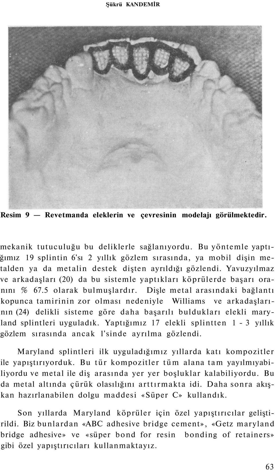 Yavuzyılmaz ve arkadaşları (20) da bu sistemle yaptıkları köprülerde başarı oranını % 67.5 olarak bulmuşlardır.