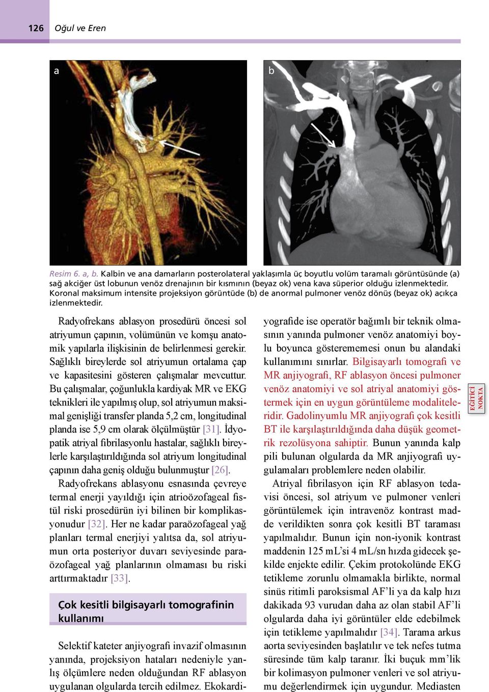 Koronal maksimum intensite projeksiyon görüntüde (b) de anormal pulmoner venöz dönüş (beyaz ok) açıkça izlenmektedir.