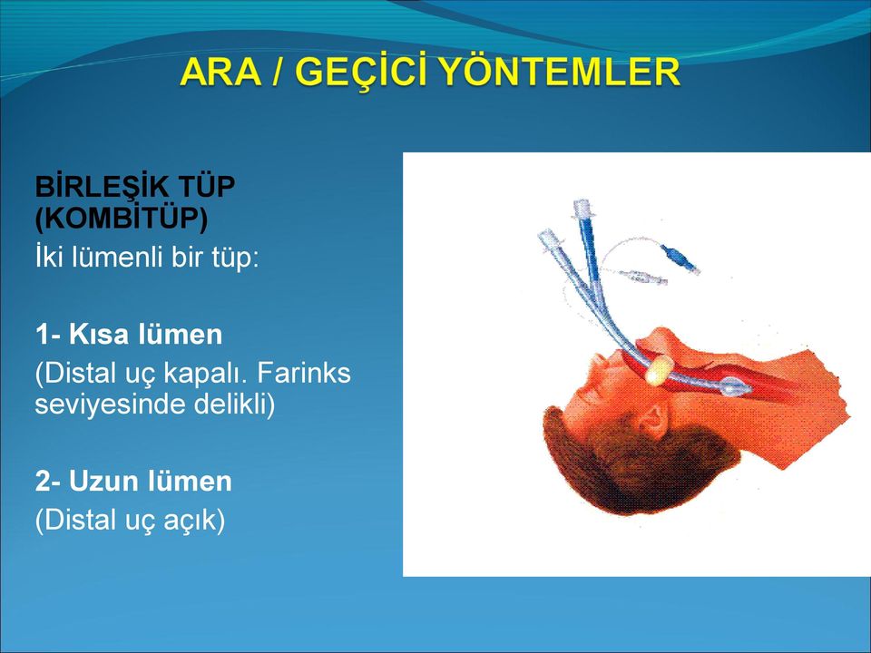 (Distal uç kapalı.