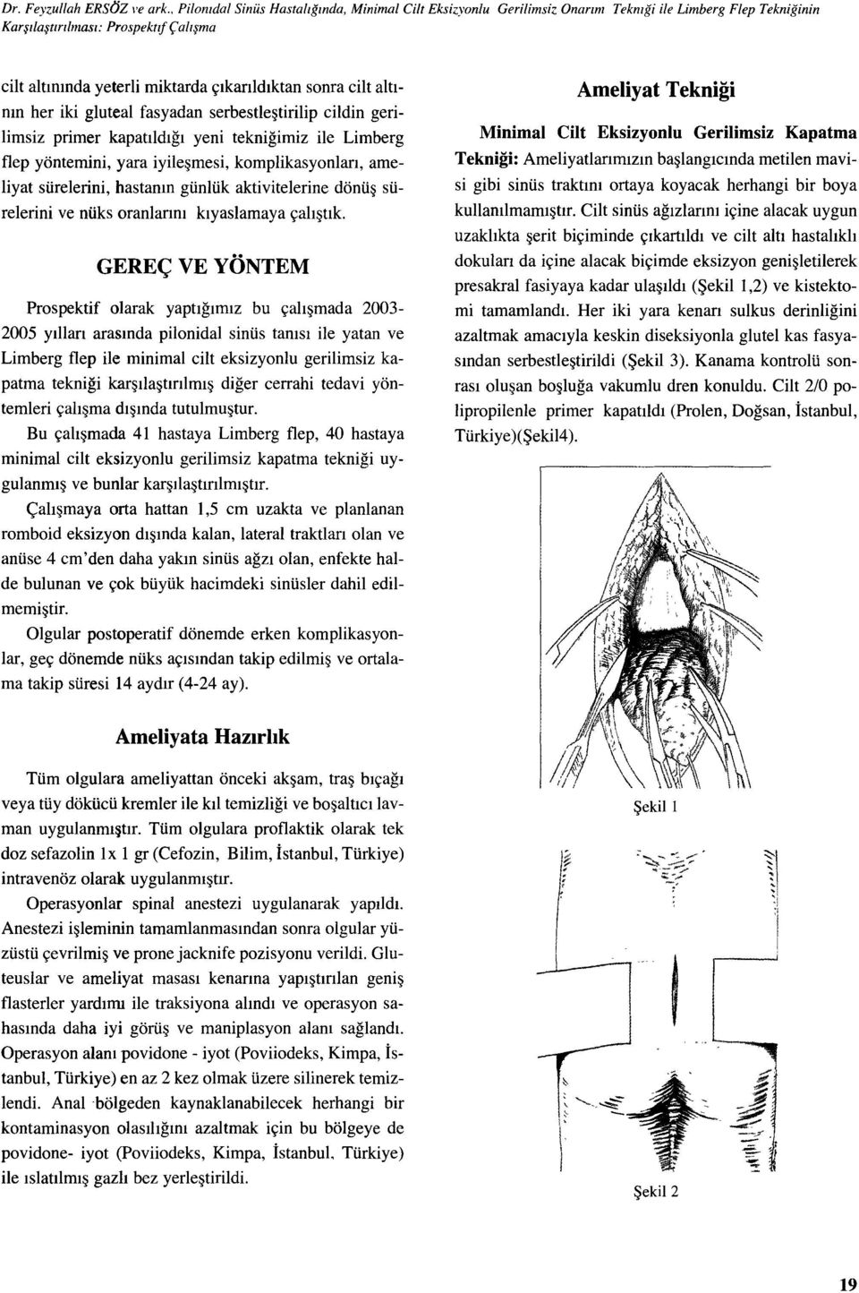 cilt altının her iki gluteal fasyadan serbestleştirilip cildin gerilimsiz primer kapatıldığı yeni tekniğimiz ile Limberg flep yöntemini, yara iyileşmesi, komplikasyonları, ameliyat sürelerini,