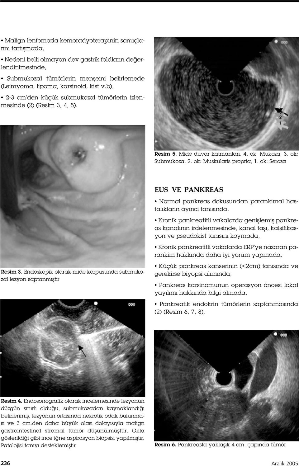 ok: Seroza Resim 3.