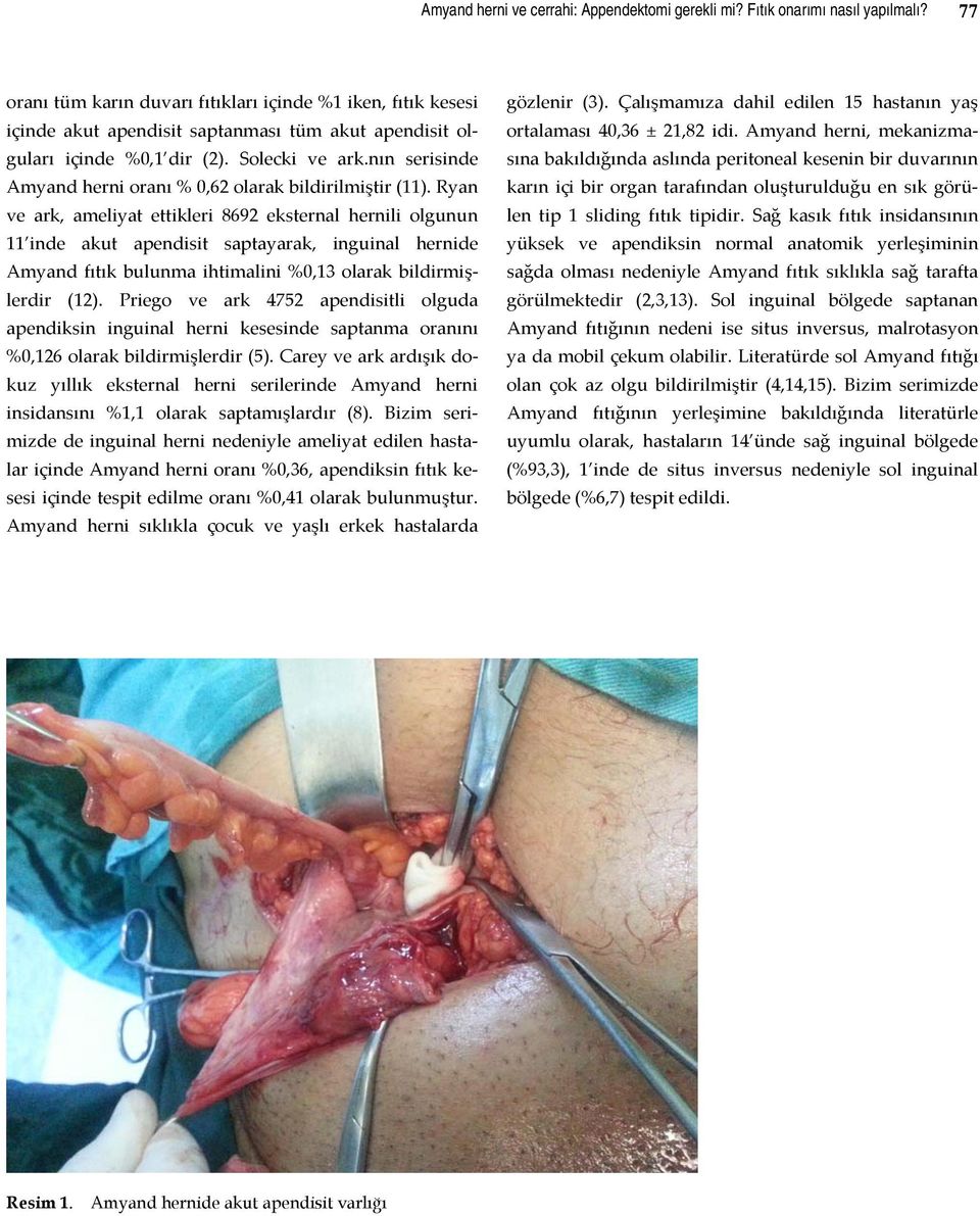 nın serisinde Amyand herni oranı % 0,62 olarak bildirilmiştir (11).