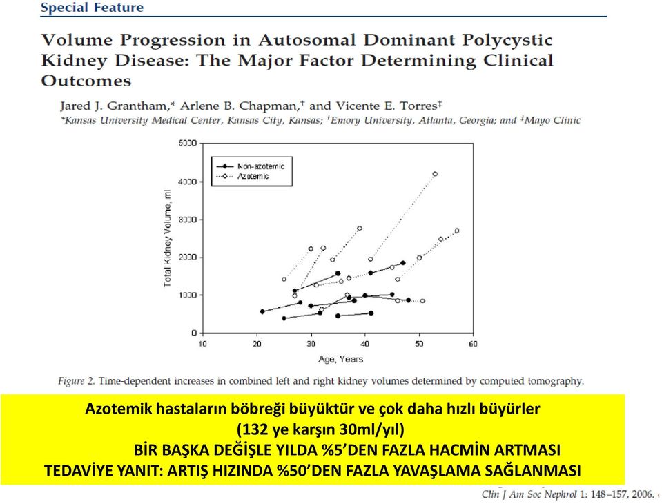 DEĞİŞLE YILDA %5 DEN FAZLA HACMİN ARTMASI TEDAVİYE