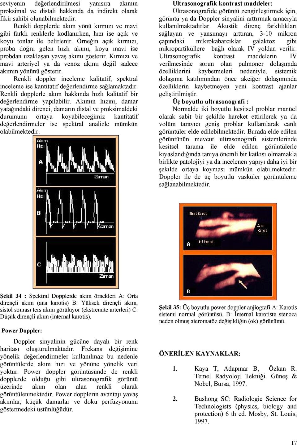 Örneğin açık kırmızı, proba doğru gelen hızlı akımı, koyu mavi ise probdan uzaklaşan yavaş akımı gösterir. Kırmızı ve mavi arteriyel ya da venöz akımı değil sadece akımın yönünü gösterir.