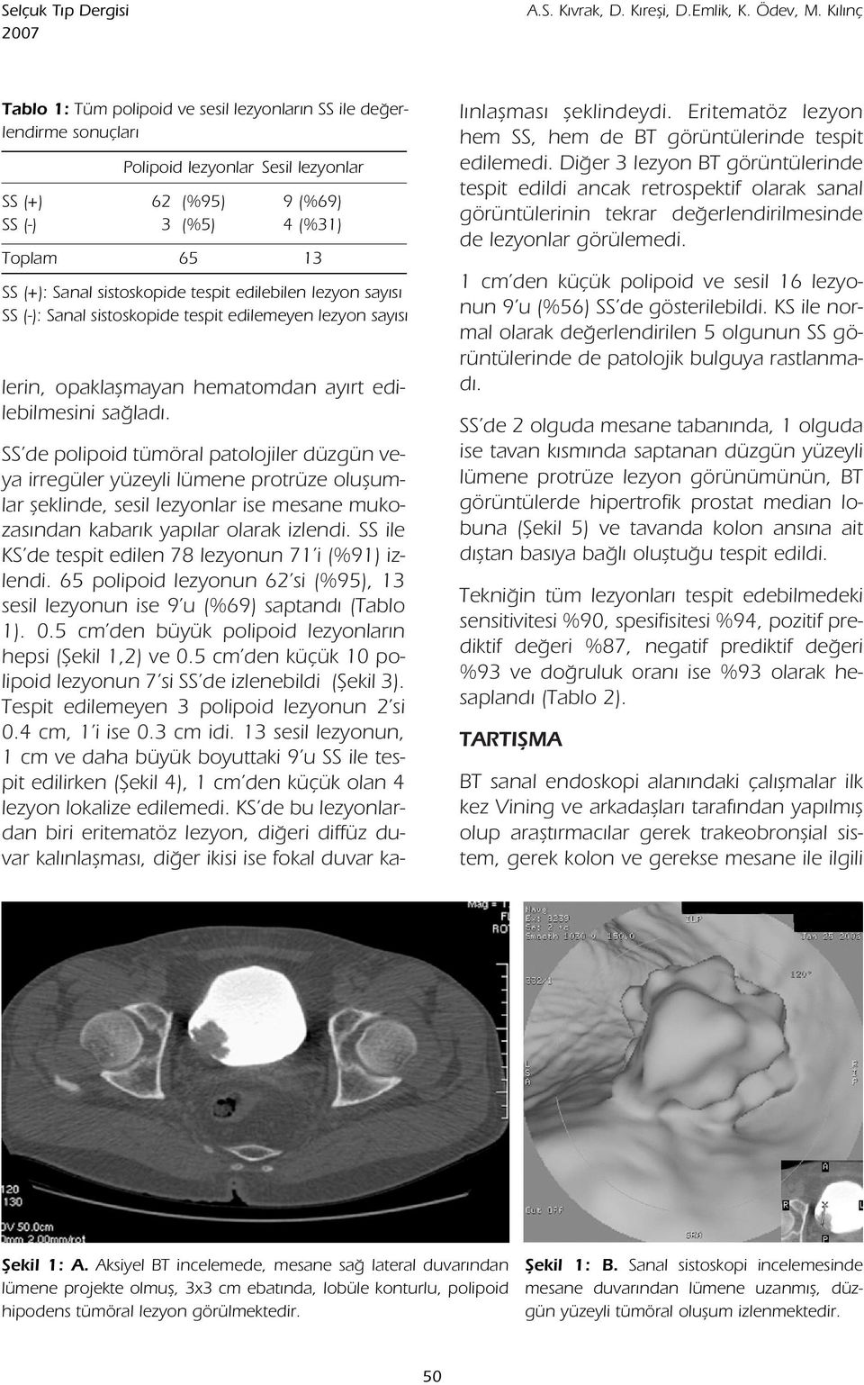 sistoskopide tespit edilebilen lezyon say s SS (-): Sanal sistoskopide tespit edilemeyen lezyon say s lerin, opaklaflmayan hematomdan ay rt edilebilmesini sa lad.