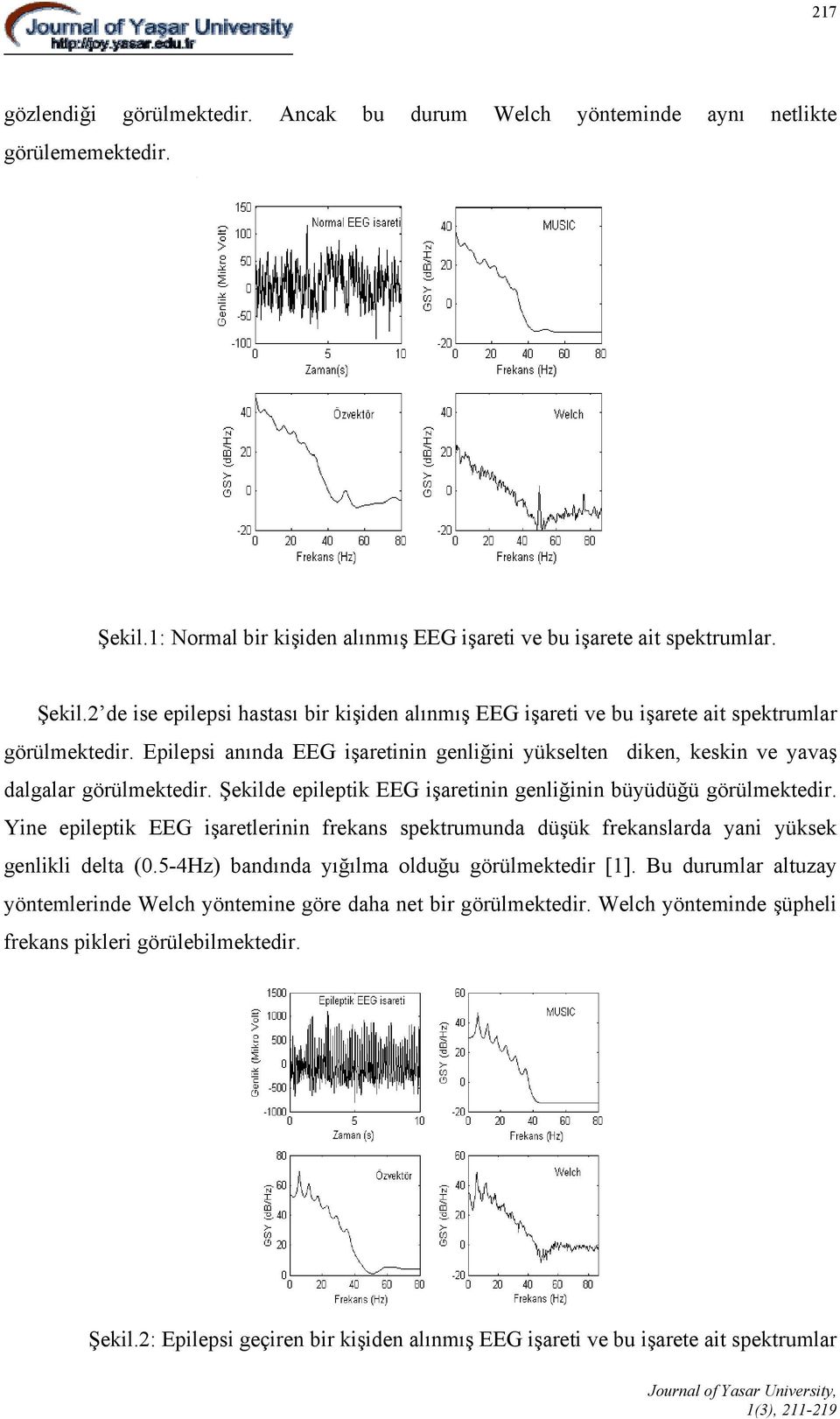 Epilepsi anında EEG işaretinin genliğini yükselten diken, keskin ve yavaş dalgalar görülmektedir. Şekilde epileptik EEG işaretinin genliğinin büyüdüğü görülmektedir.