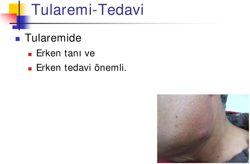 Erken tanı ve