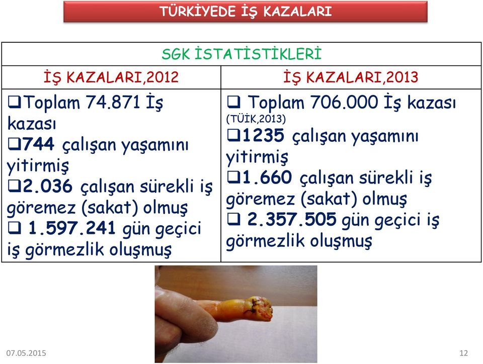 241 gün geçici iş görmezlik oluşmuş SGK İSTATİSTİKLERİ İŞ KAZALARI,2013 Toplam 706.