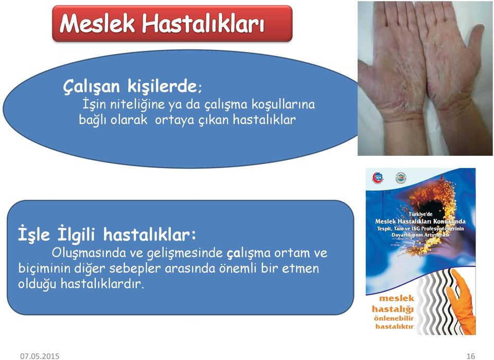 hastalıklar: Oluşmasında ve gelişmesinde çalışma ortam ve