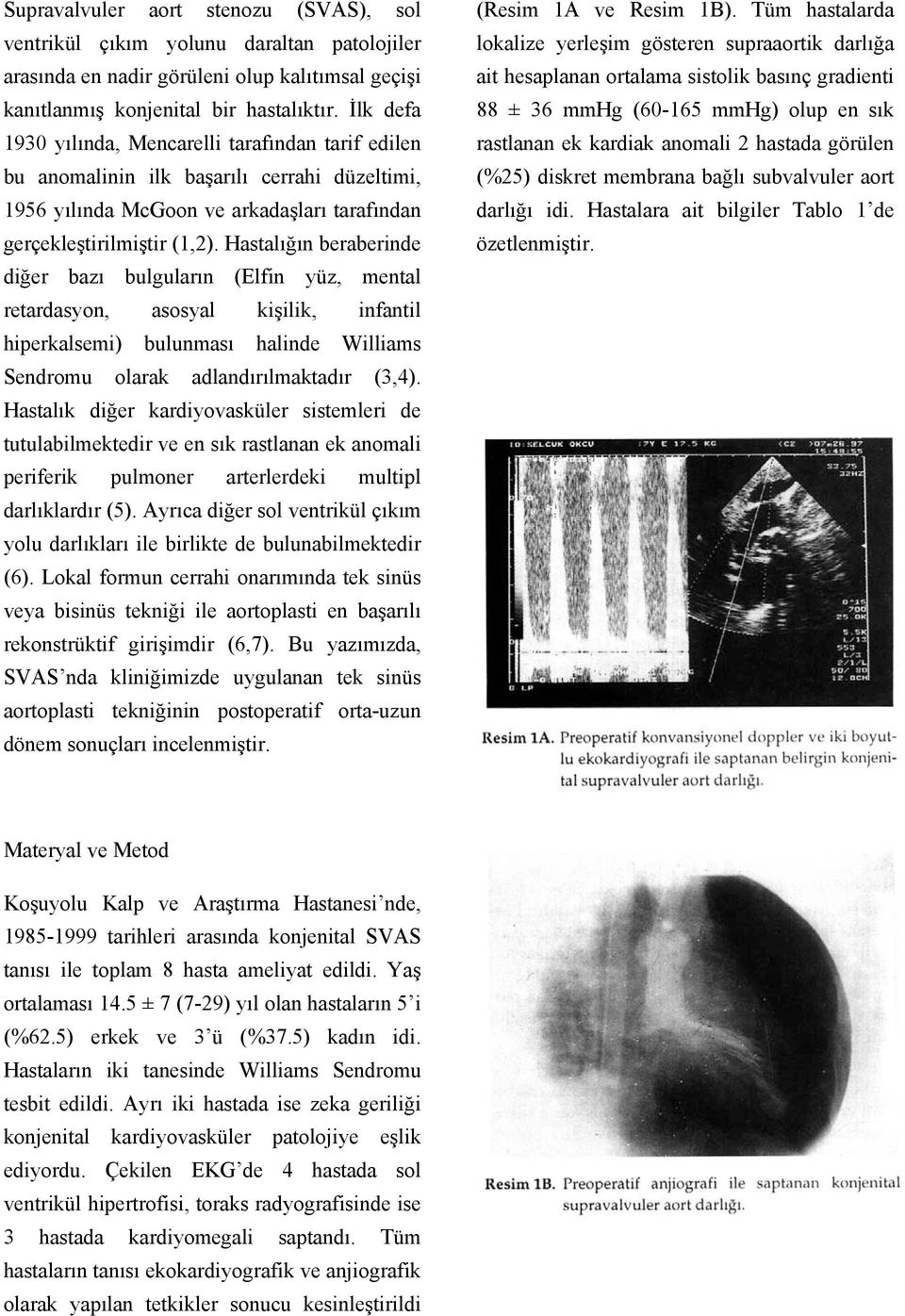 Hastalığın beraberinde diğer bazı bulguların (Elfin yüz, mental retardasyon, asosyal kişilik, infantil hiperkalsemi) bulunması halinde Williams Sendromu olarak adlandırılmaktadır (3,4).