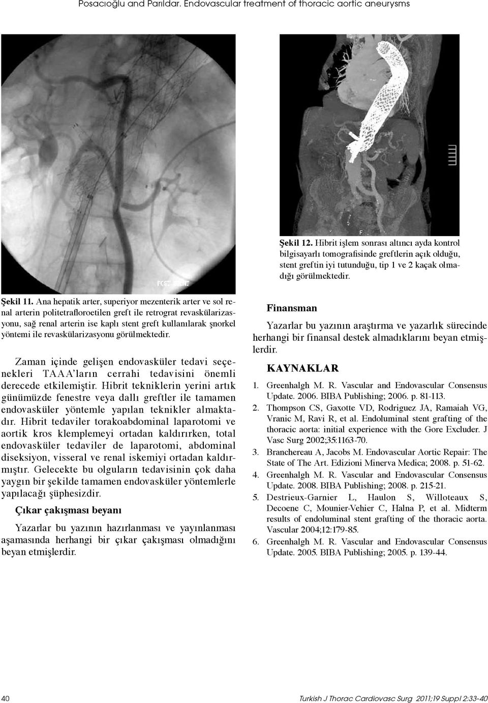 Ana hepatik arter, superiyor mezenterik arter ve sol renal arterin politetrafloroetilen greft ile retrograt revaskülarizasyonu, sağ renal arterin ise kaplı stent greft kullanılarak şnorkel yöntemi