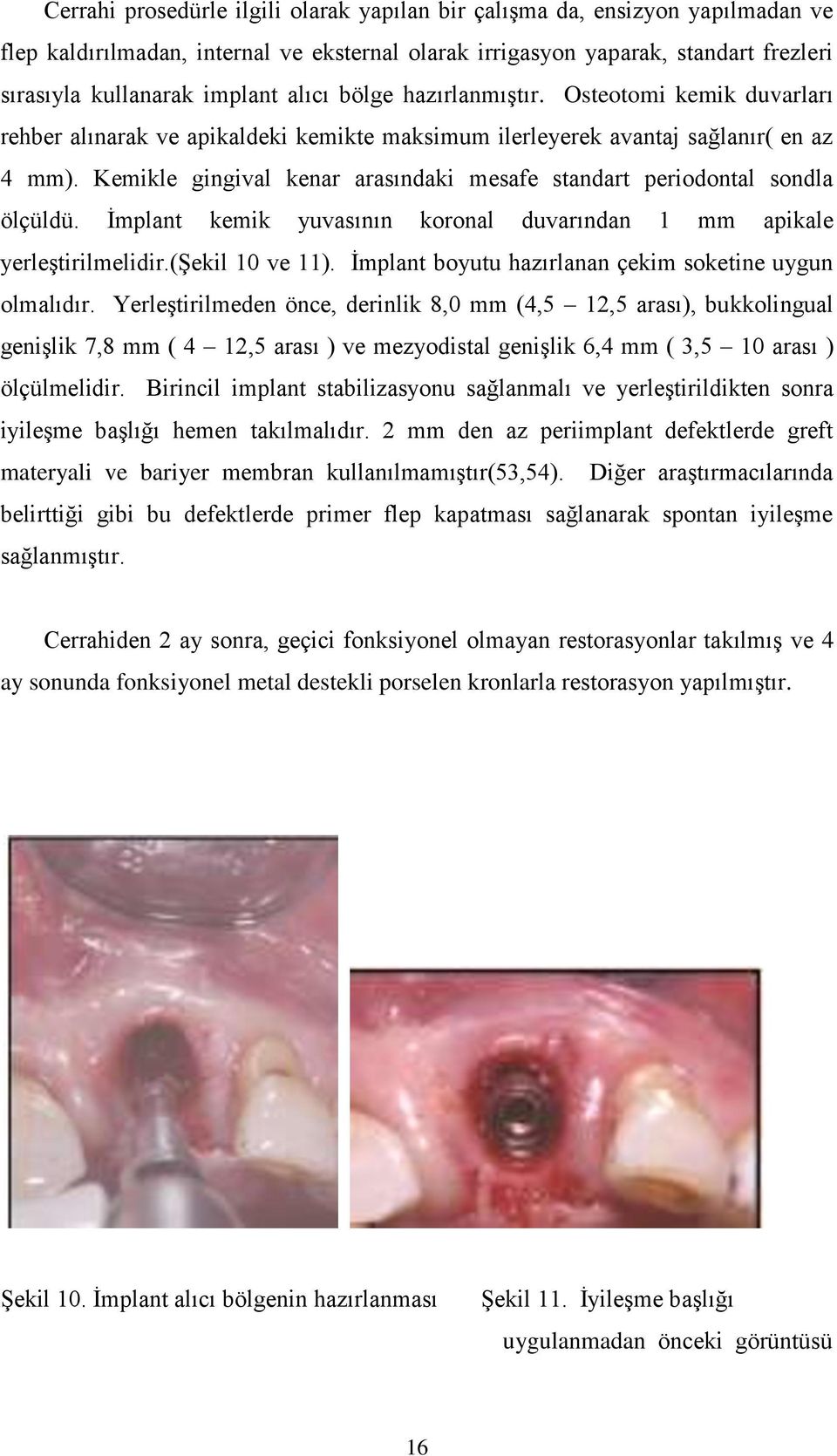 Kemikle gingival kenar arasındaki mesafe standart periodontal sondla ölçüldü. İmplant kemik yuvasının koronal duvarından 1 mm apikale yerleştirilmelidir.(şekil 10 ve 11).