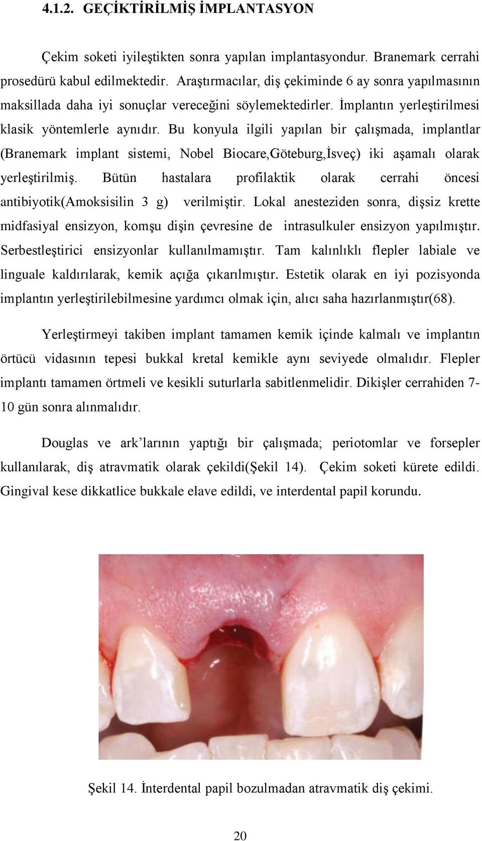 Bu konyula ilgili yapılan bir çalışmada, implantlar (Branemark implant sistemi, Nobel Biocare,Göteburg,İsveç) iki aşamalı olarak yerleştirilmiş.