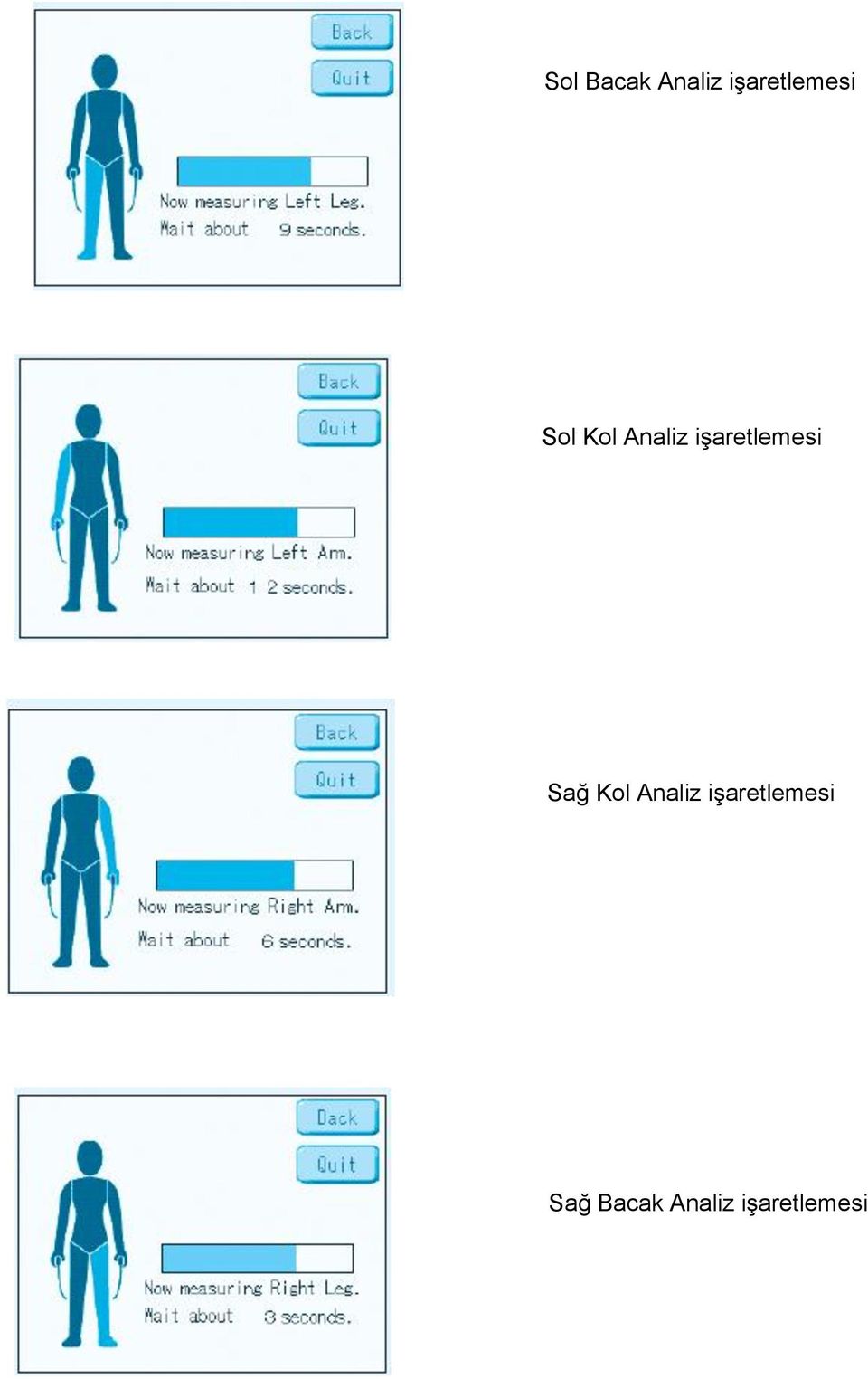 işaretlemesi Sağ Kol Analiz