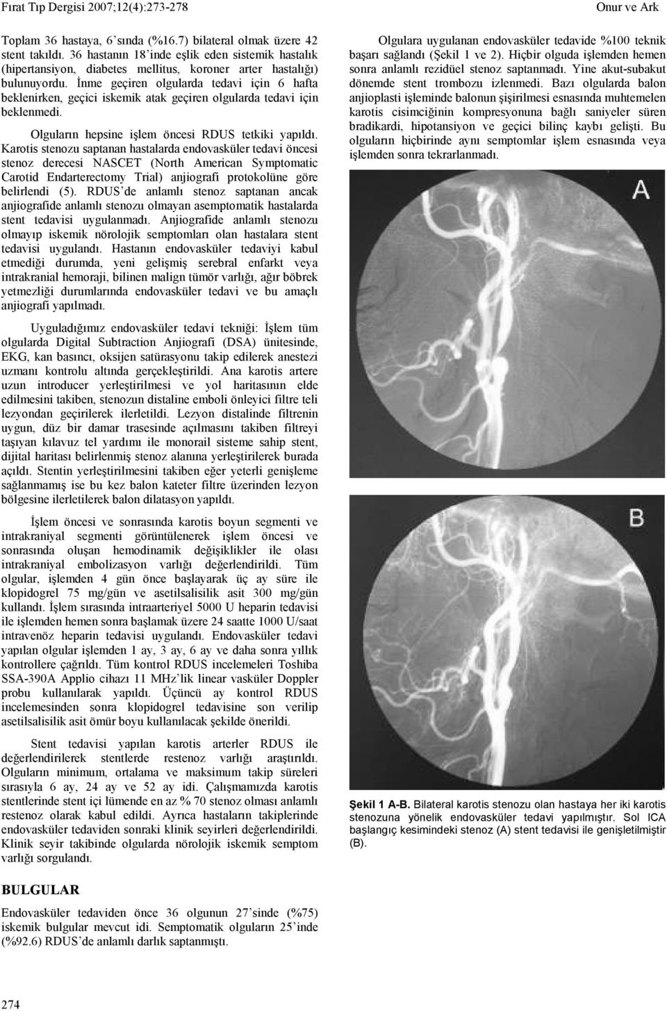 Karotis stenozu saptanan hastalarda endovasküler tedavi öncesi stenoz derecesi NASCET (North American Symptomatic Carotid Endarterectomy Trial) anjiografi protokolüne göre belirlendi (5).