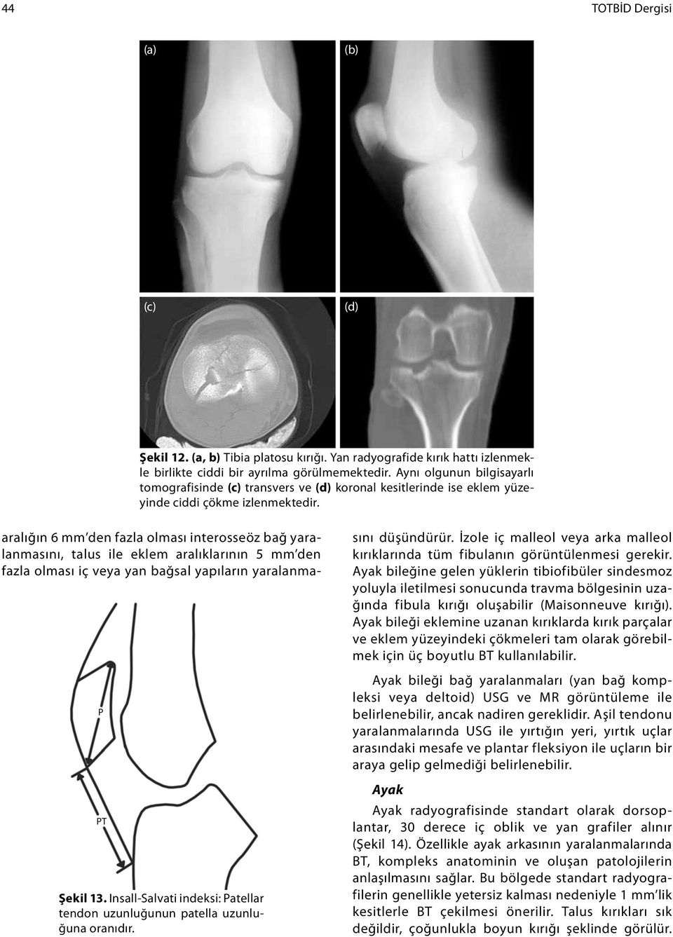 Insall-Salvati indeksi: Patellar tendon uzunluğunun patella uzunluğuna oranıdır.