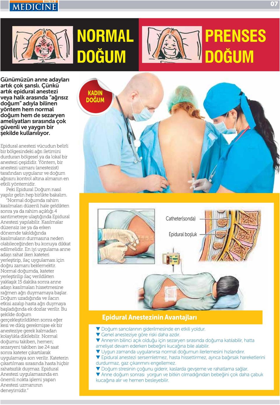 KADIN DOĞUM Epidural anestezi vücudun belirli bir bölgesindeki ağrı iletimini durduran bölgesel ya da lokal bir anestezi çeşididir.