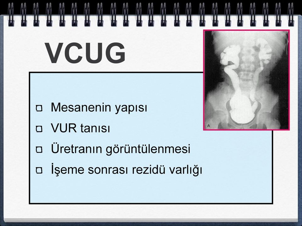 görüntülenmesi İşeme