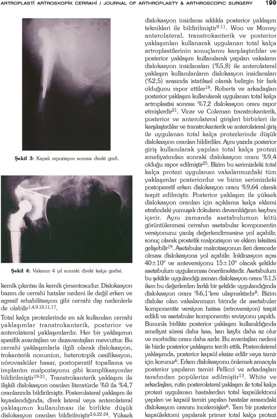 Total kalça protezlerinde en sýk kullanýlan cerrahi yaklaþýmlar transtrokanterik, posterior ve anterolateral yaklaþýmlardýr. Her bir yaklaþýmýn spesifik avantajlarý ve dezavantajlarý mevcuttur.