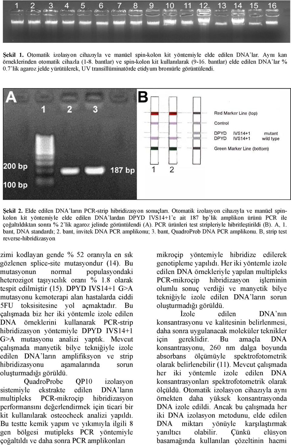 Otomatik izolasyon cihazıyla ve manüel spinkolon kit yöntemiyle elde edilen DNA lardan DPYD IVS14+1 e ait 187 bp lik amplikon ürünü PCR ile çoğaltıldıktan sonra % 2 lik agaroz jelinde görüntülendi