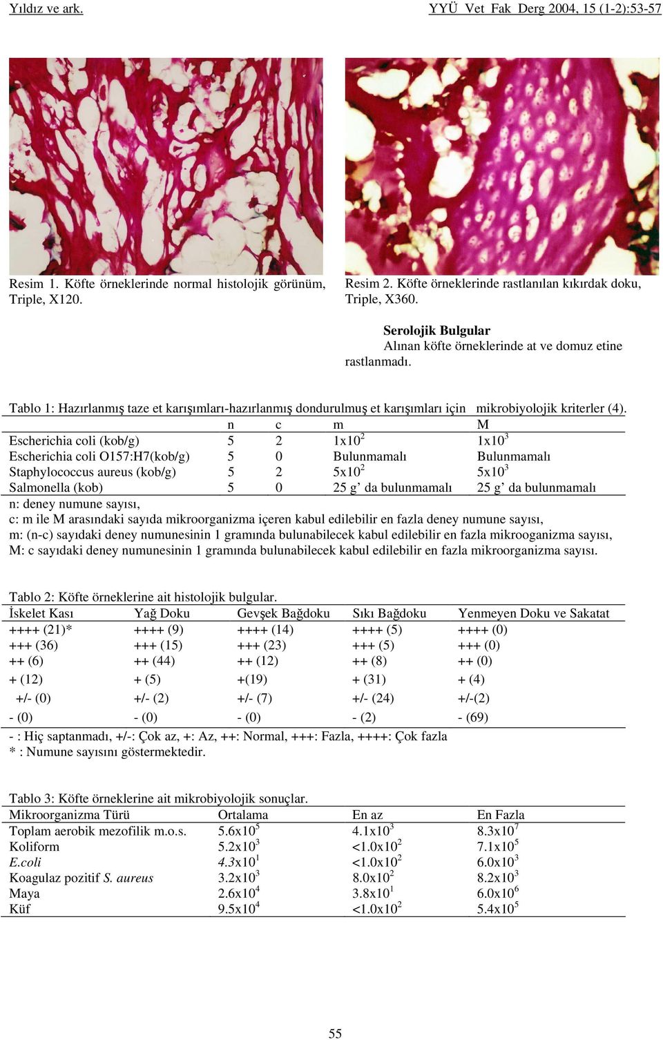 n c m M Escherichia coli (kob/g) 5 2 1x10 2 1x10 3 Escherichia coli O157:H7(kob/g) 5 0 Bulunmamalı Bulunmamalı Staphylococcus aureus (kob/g) 5 2 5x10 2 5x10 3 Salmonella (kob) 5 0 25 g da bulunmamalı