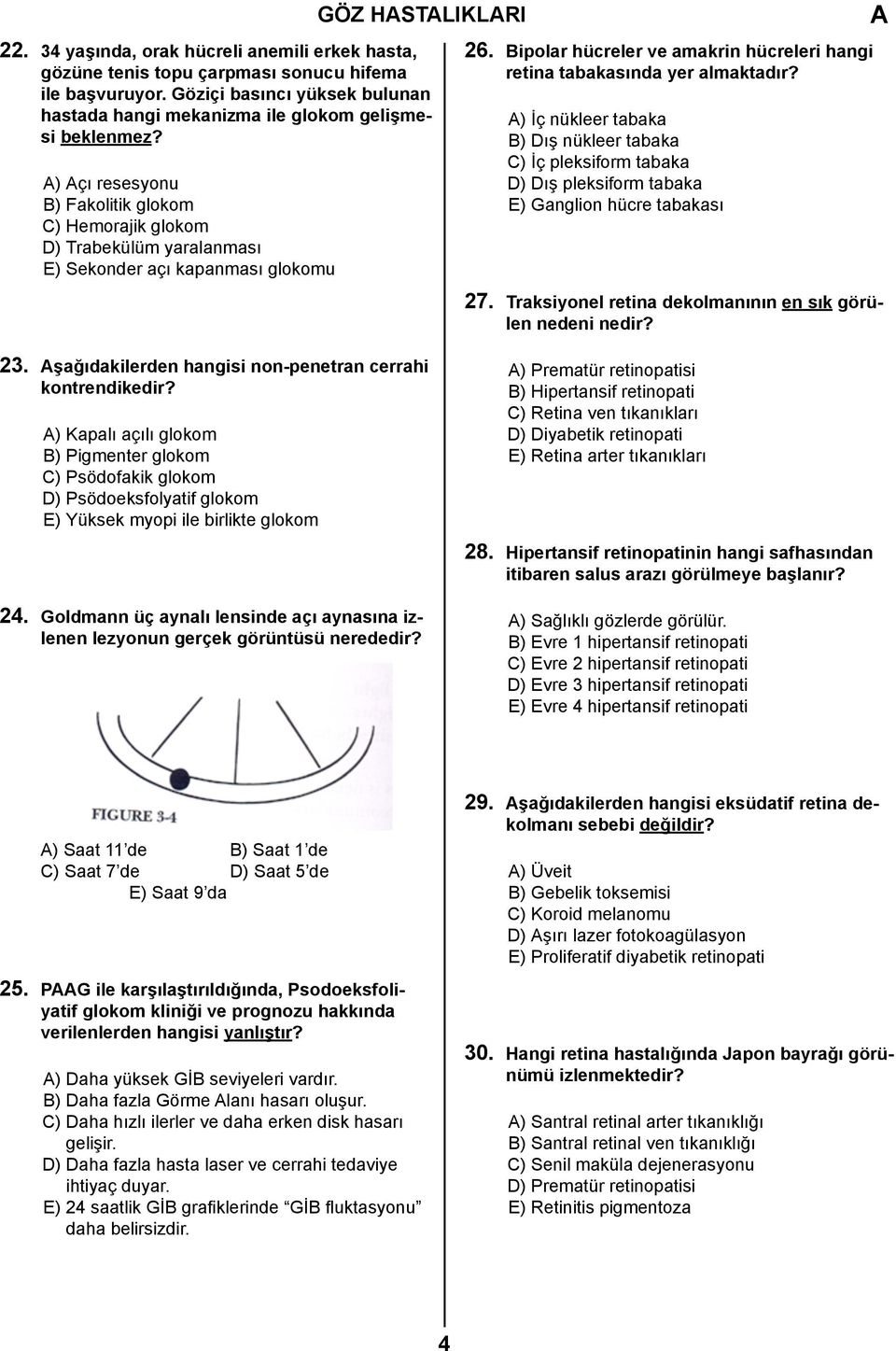 ) çı resesyonu B) Fakolitik glokom C) Hemorajik glokom D) Trabekülüm yaralanması E) Sekonder açı kapanması glokomu 26. Bipolar hücreler ve amakrin hücreleri hangi retina tabakasında yer almaktadır?