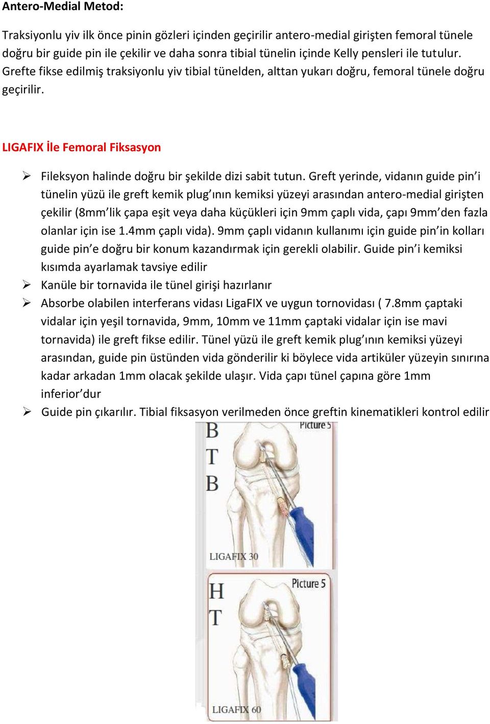 LIGAFIX İle Femoral Fiksasyon Fileksyon halinde doğru bir şekilde dizi sabit tutun.