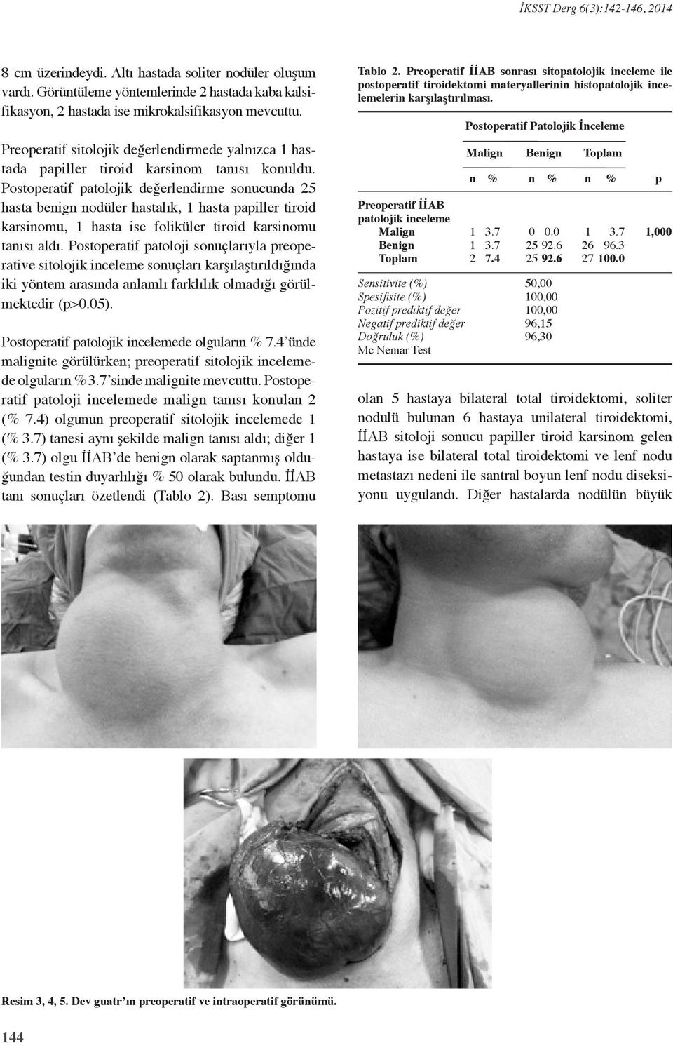 Postoperatif patolojik değerledirme soucuda 25 hasta beig odüler hastalık, hasta papiller tiroid karsiomu, hasta ise foliküler tiroid karsiomu taısı aldı.