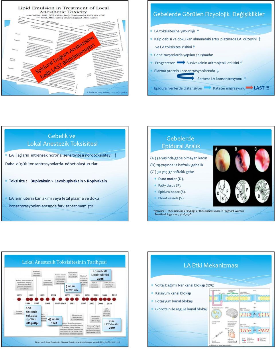 etkisini * Plazma protein konsantrasyonlarında Serbest LA konsantrasyonu J. Perianesthesia Nursing. 2015, 30(4): 308-20 * Epidural venlerde distansiyon Kateter migrasyonu LAST!