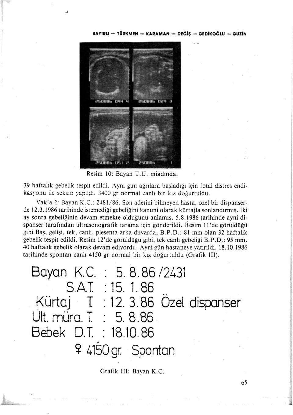 İki ay sonra gebeliğinin devam etmekte olduğunu anlamış. 5.8.1986 tarihinde ayni dispanser tarafından ultrasonografik tarama için gönderildi. Resim 11 'de görüldüğü gibi Baş.