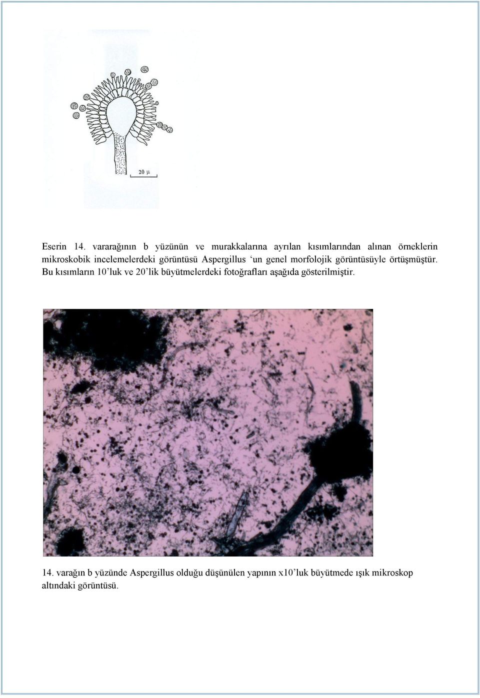 mikroskobik incelemelerdeki görüntüsü Aspergillus un genel morfolojik görüntüsüyle